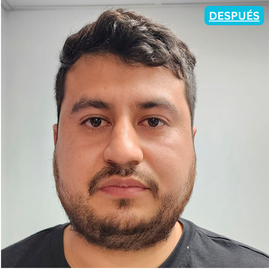 Después