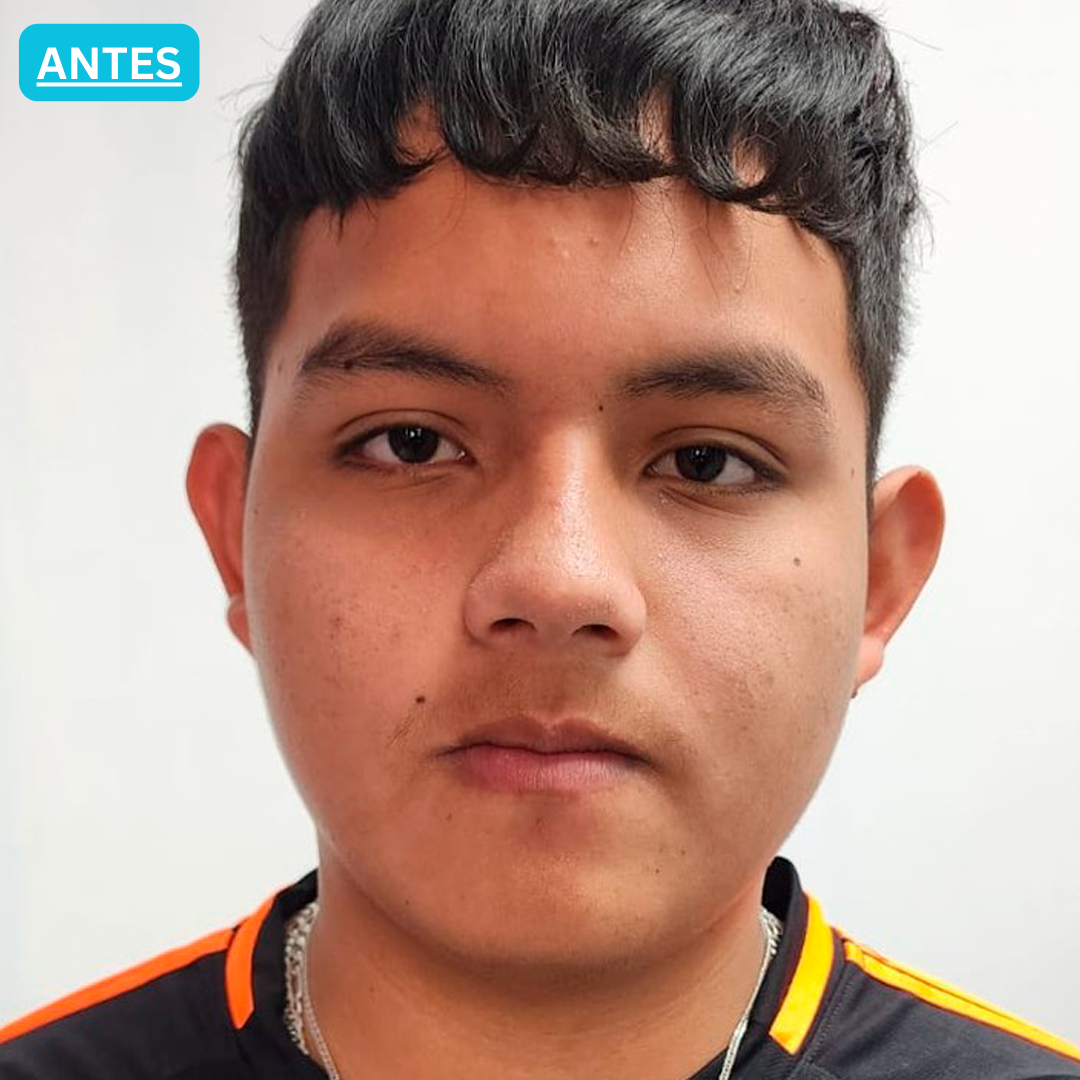 Antes