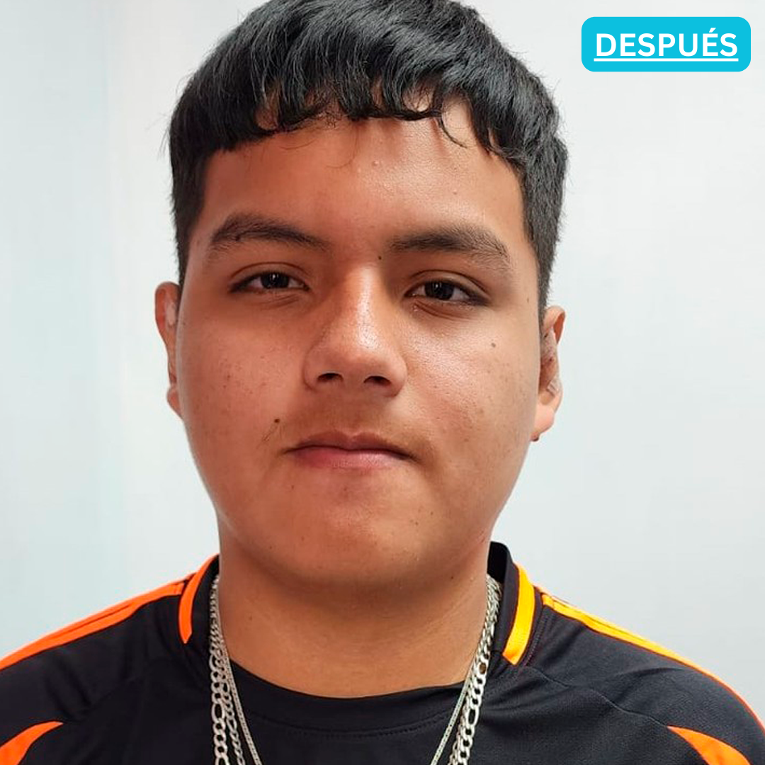 Después