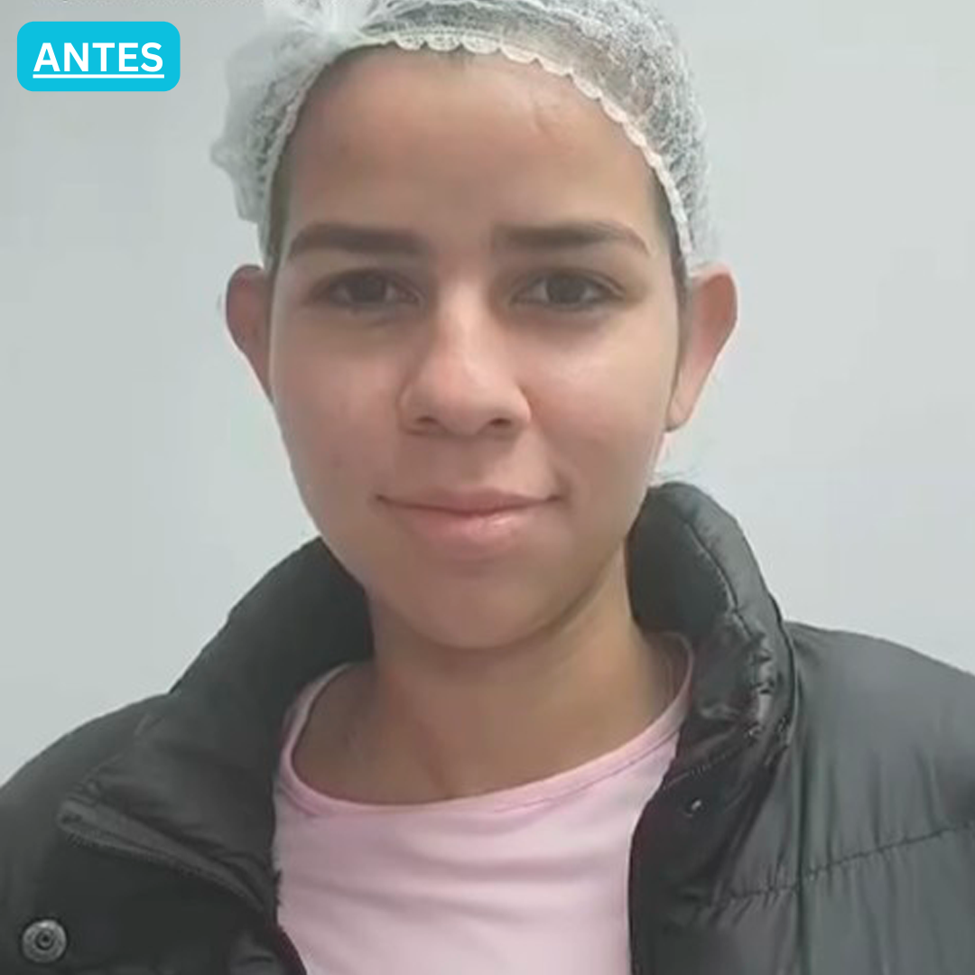 Antes